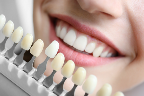 Why Now is the Perfect Time for Enlighten Dental Whitening