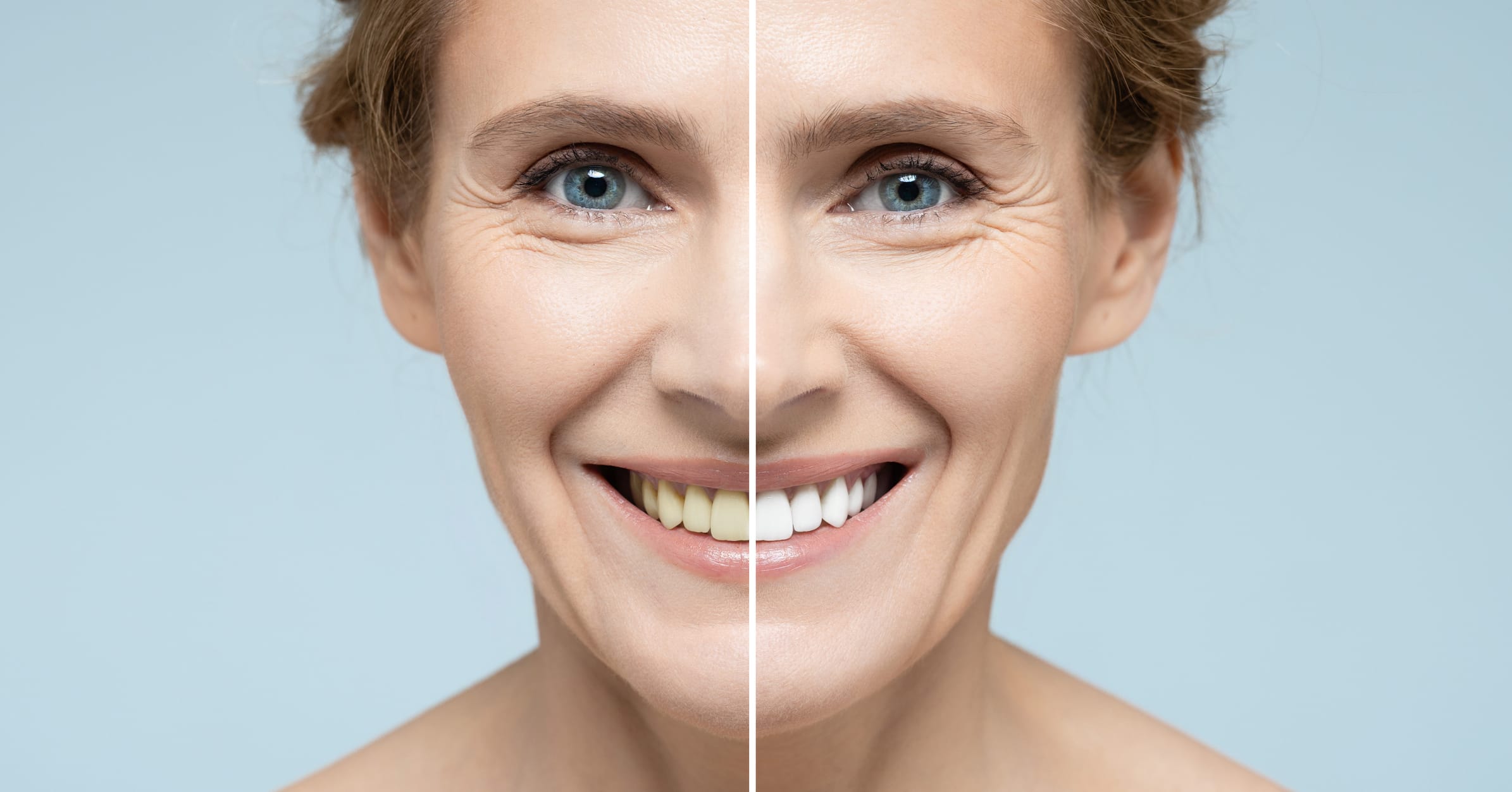 Enlighten Whitening - brighten your smile this Valentine’s Day with our special offer